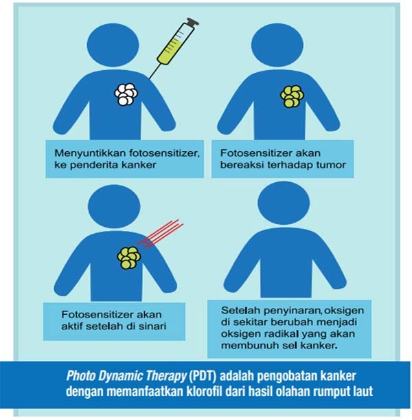 Photo Dynamic Therapy (PDT)