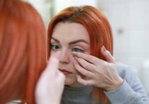 mengatasi mata kering